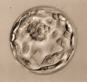 供卵试管婴儿多少钱才能成功