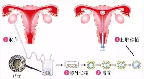 供卵试管婴儿有最高年龄限制吗？