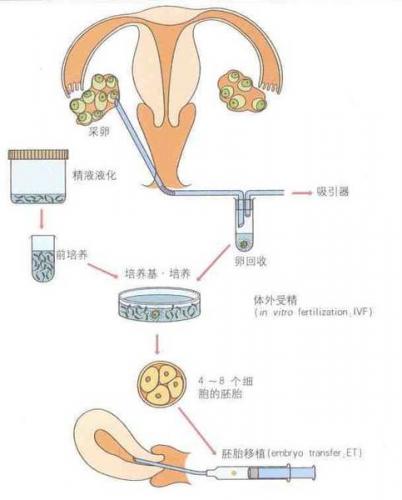 促排卵导致提前绝经是真的吗？河南郑州赠卵