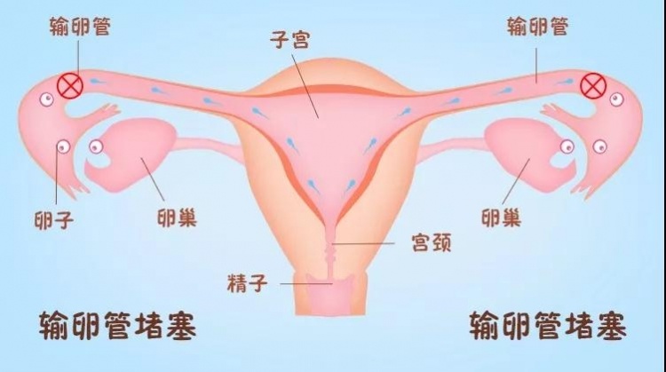 40岁的女性做供卵做试管婴儿能否一次成功，40岁做供卵做试管婴儿的成功率是多少？