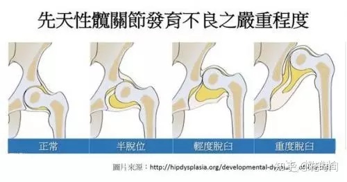 如何计算赠卵试管婴儿怀孕的预产期