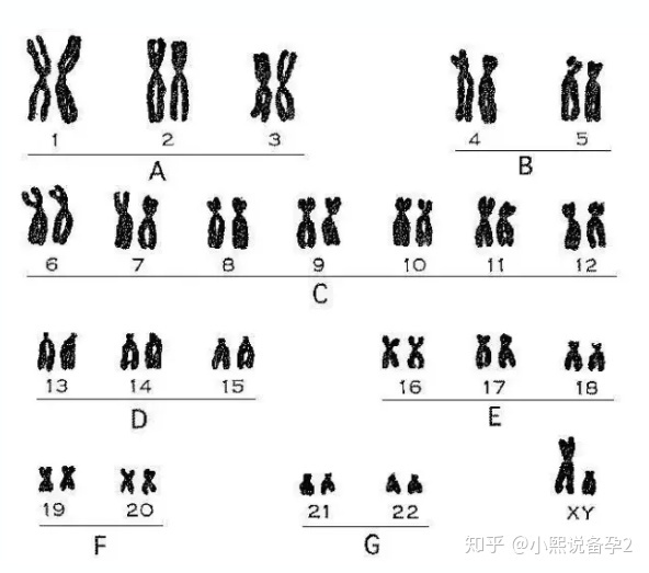 纵隔子宫可以生孩子吗？什么是唐氏筛查？我可以不做吗？