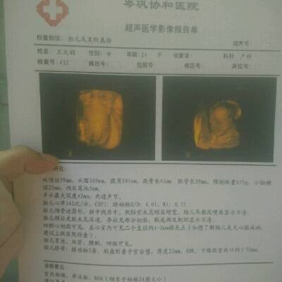 清远供卵医院认准宝来喜助孕代生