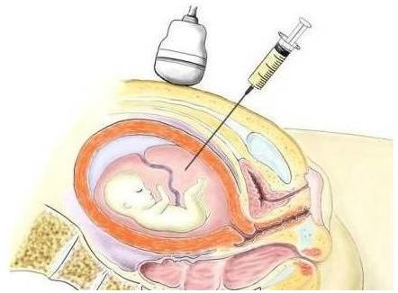 黑龙江省佳木斯市妇幼保健院能做供卵试管吗内附医院供卵现状