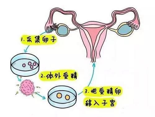 河南郑州赠卵试管婴儿咨询网站