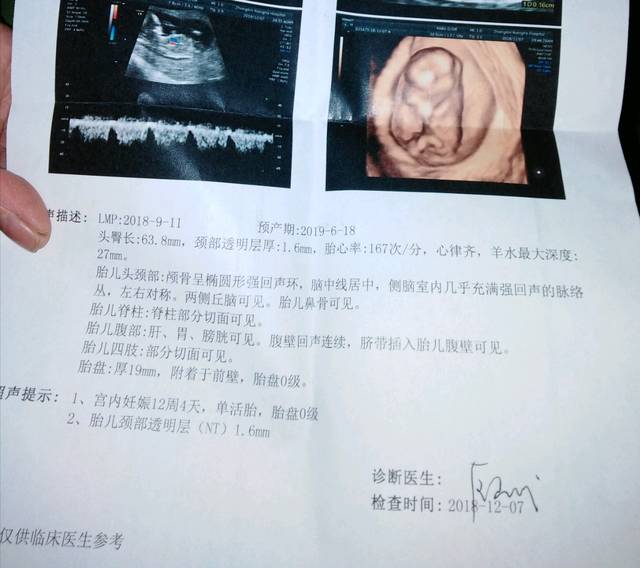 老公不知道孩子是供卵生的