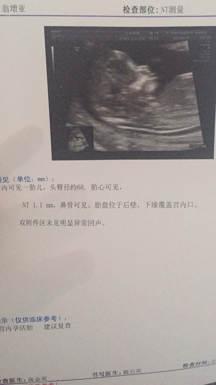 郑州哪里借卵做试管比较好