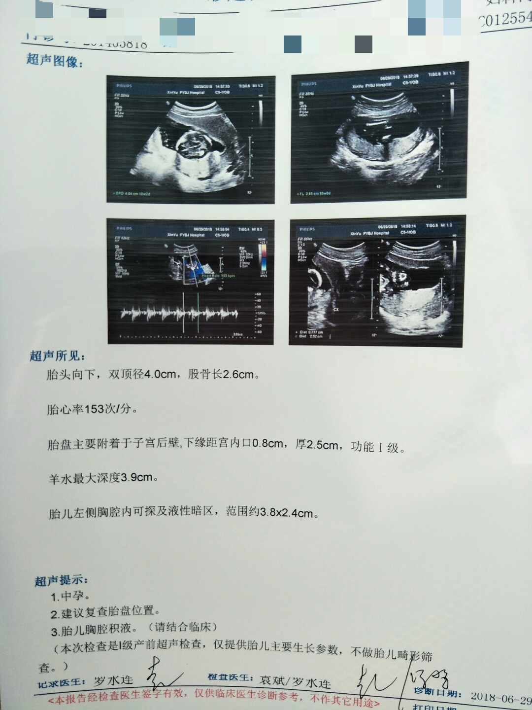 供卵试管婴儿怀孕是从哪一天算起的