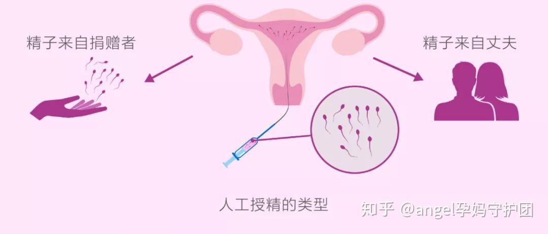 郑州能冻卵吗+国内能冻卵吗
