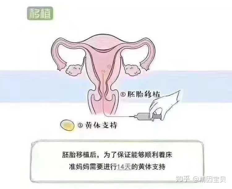 2023第三代河南试管代怀产子包生女孩价格是多少