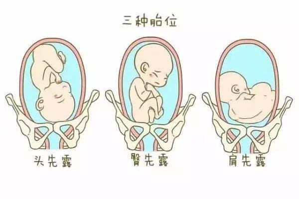 孩子真的是心酸泪期盼河南第三代王站长试管代怀孕移植顺利!