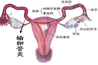 调经促孕丸不可随便吃,输卵管问题和多囊卵巢并非都能治