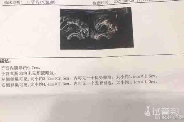 私人医院借卵代生代怀选男孩能成功吗（要多少钱？）