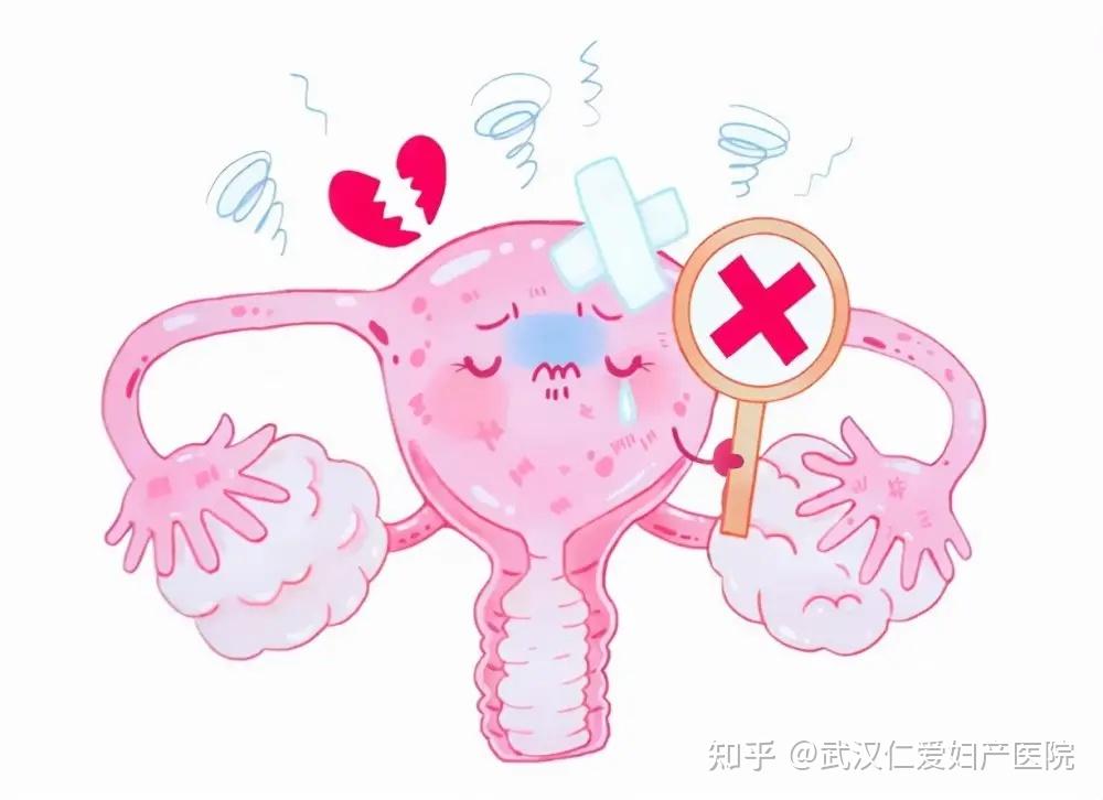供应卵巢保养仪器+供应卵巢保养精油