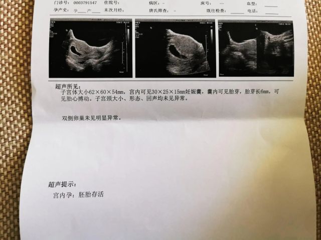 在澳洲试管代怀合同的效力婴儿多少钱+澳洲试管代怀产子到哪里找价格多少钱