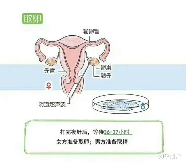 打排卵针怀了双胞胎（打了排卵针后怀了双胞胎）