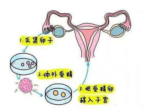 第一次试管,希望好孕