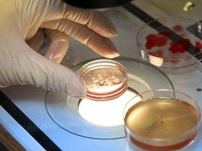 多囊卵巢女方不孕试管代怀一次成功-多囊卵