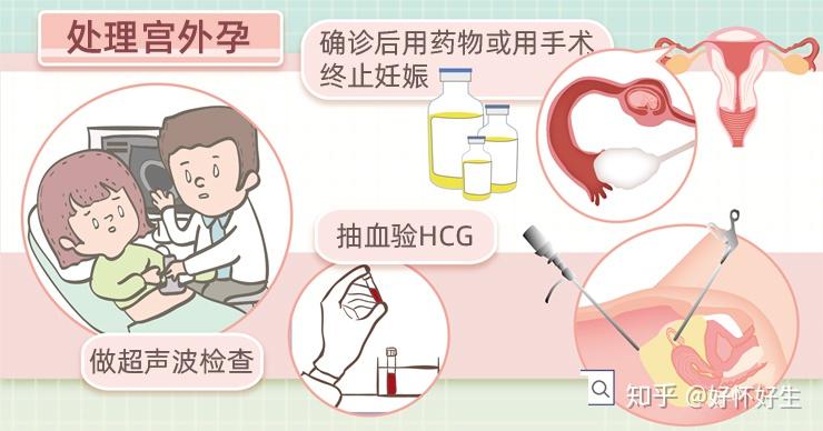 试管怀孕后饮食原则这些食物不能吃