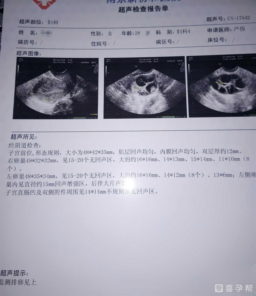 郑州私人医院试管包男孩婴儿好的医院是郑州邵逸夫吗